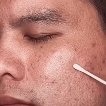 Révélez une peau plus nette et éclatante en seulement 72h —le Green Mask transforme votre routine en un vrai moment de renouveau.