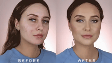 Révélez une peau plus nette et éclatante en seulement 72h —le Green Mask transforme votre routine en un vrai moment de renouveau.