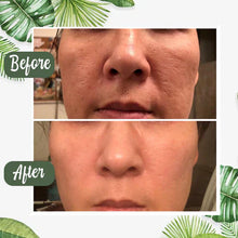 Révélez une peau plus nette et éclatante en seulement 72h —le Green Mask transforme votre routine en un vrai moment de renouveau.